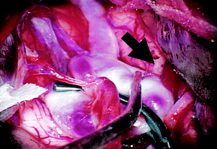 Fig 4.