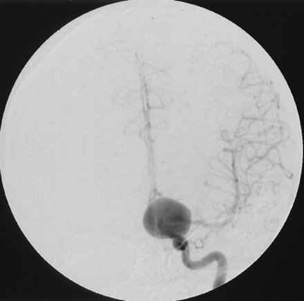 Fig 1.