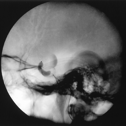 Fig 3.