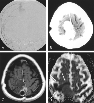 Fig 1.