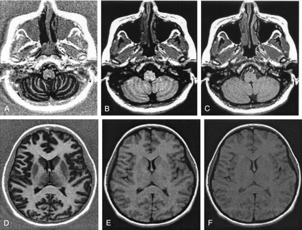 Fig 3.