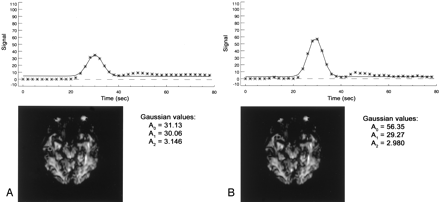Fig 1.