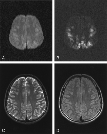 Fig 5.