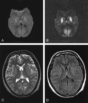Fig 6.