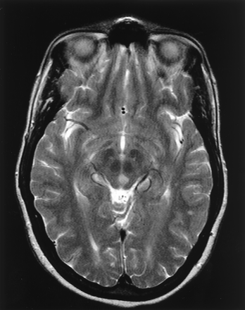 Fig 2.