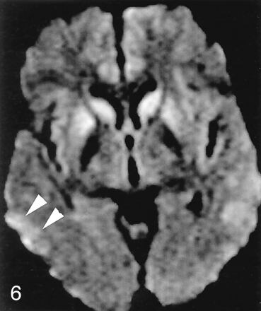 Fig 6.