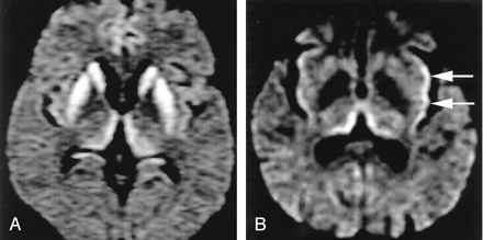 Fig 7.