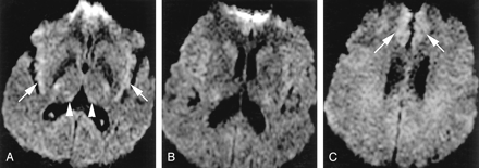 Fig 8.
