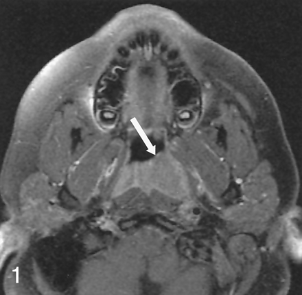 Fig 1.