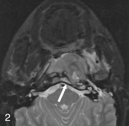 Fig 2.