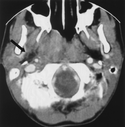 Fig 4.