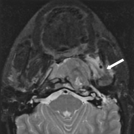 Fig 6.