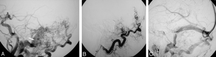 Fig 3.