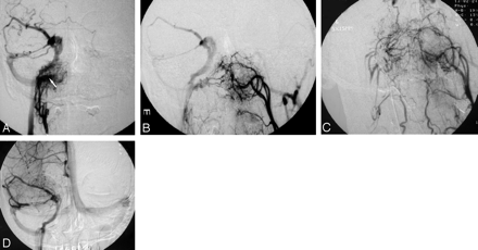 Fig 4.