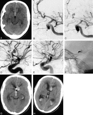 Fig 2.