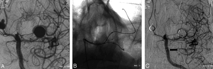 Fig 1.
