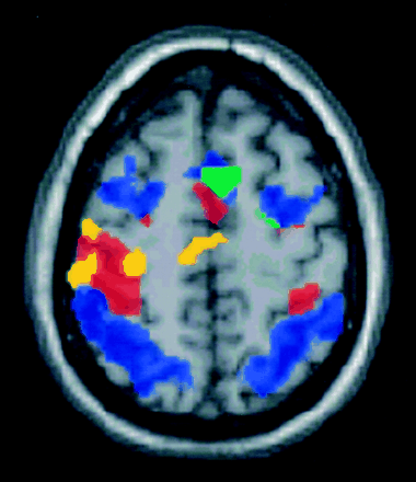 Fig 3.