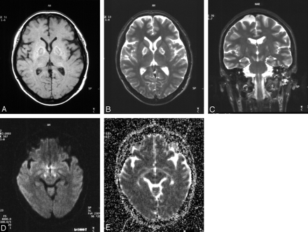 Fig 2.