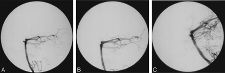 Fig 2.