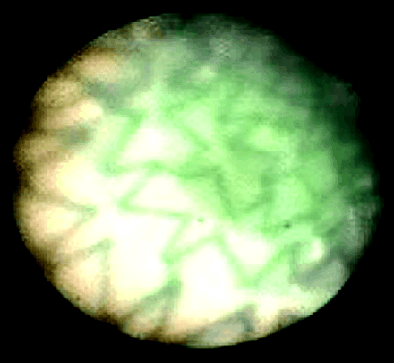 Fig 2.