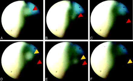 Fig 3.