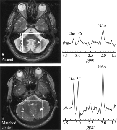Fig 1.