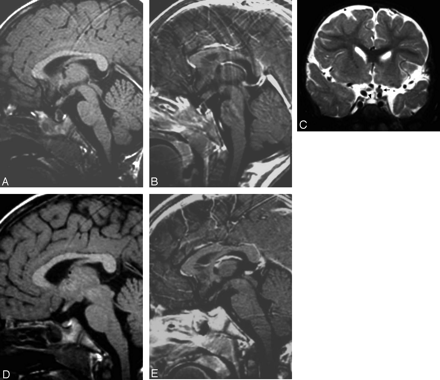 Fig 2.