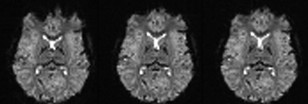 Fig 13.