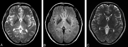Fig 2.