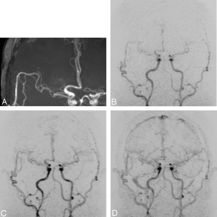 Fig 1.