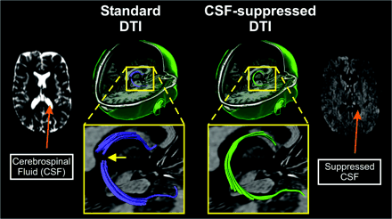 Fig 4.