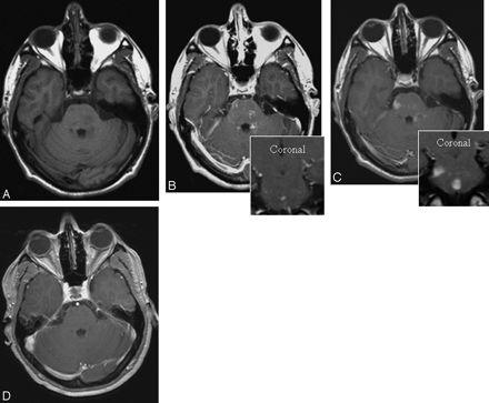 Fig 2.