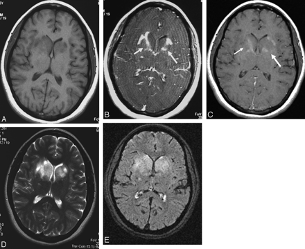 Fig 3.