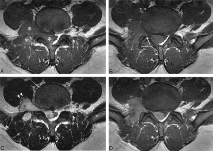 Fig 1.