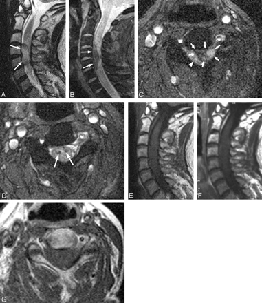 Fig 1.