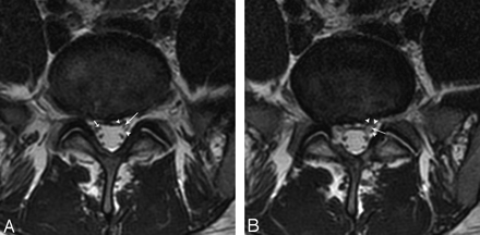 Fig 2.
