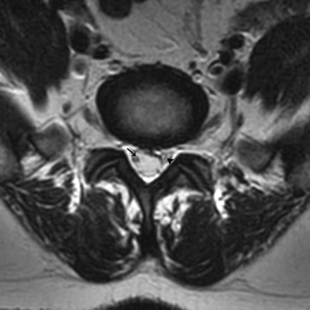 Fig 3.