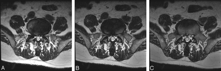 Fig 4.