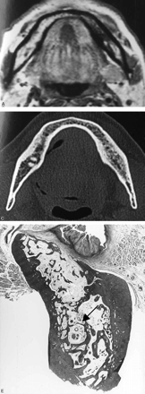 Fig 6.