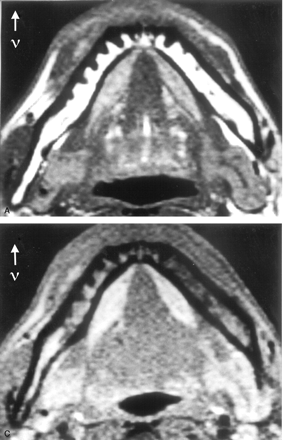 Fig 7.