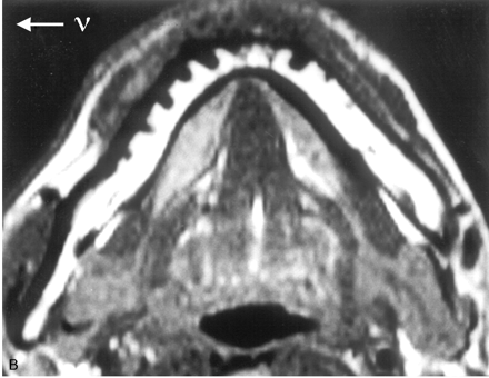 Fig 7.