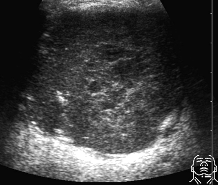 Fig 1.