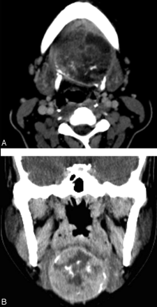 Fig 2.