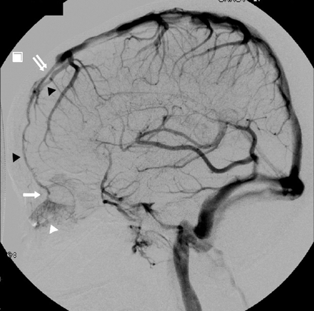 Fig 1.