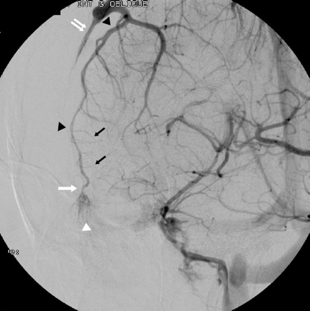 Fig 3.