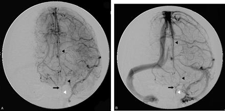 Fig 4.