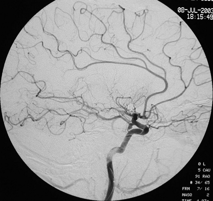 Fig 1.