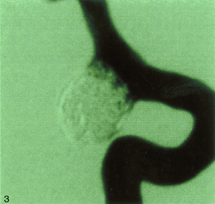 Fig 3.