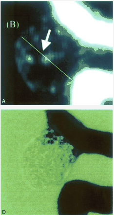 Fig 5.