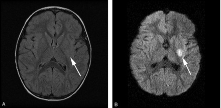 Fig 1.